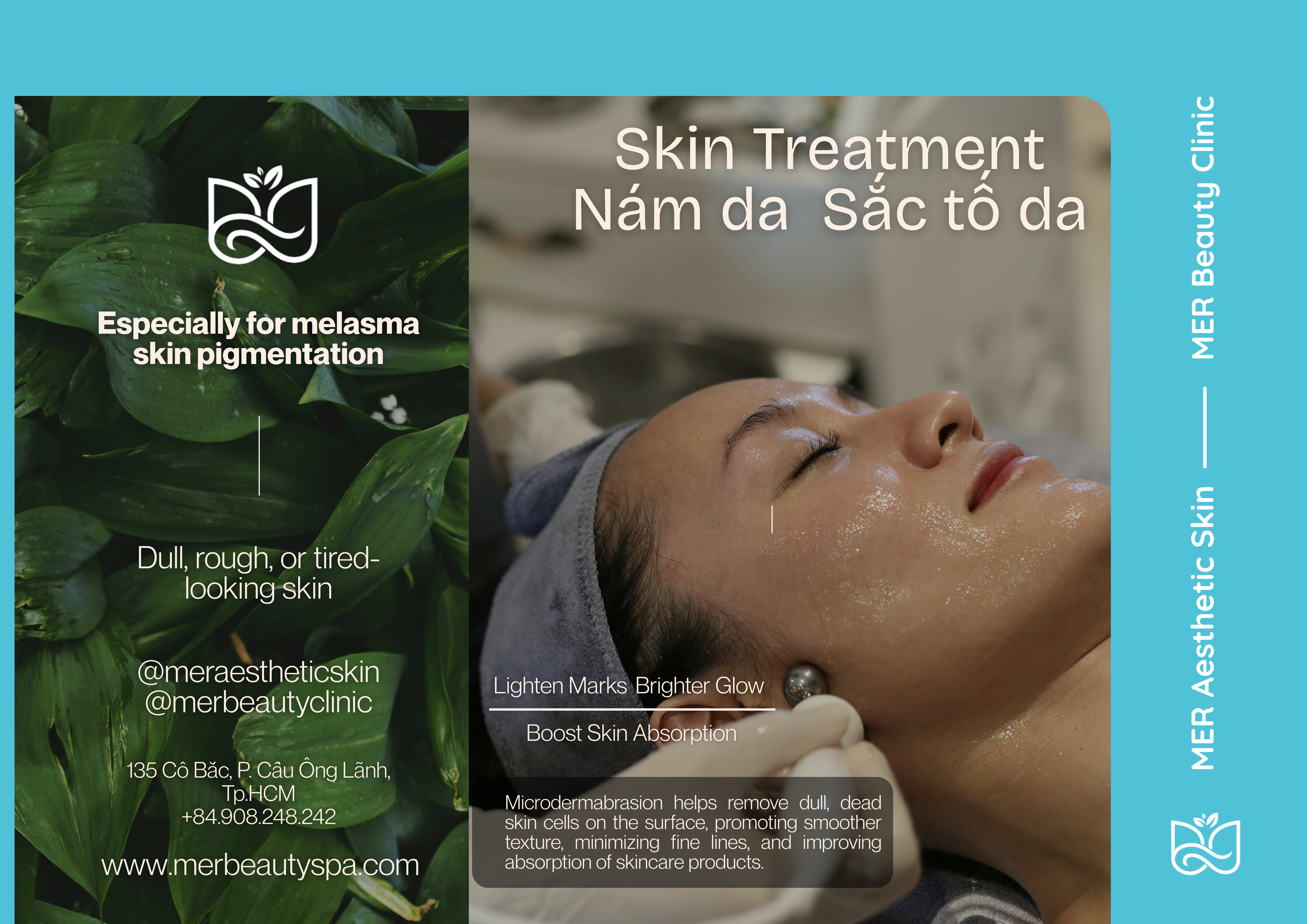 điều trị nám da chuẩn y khoa tại mer spa